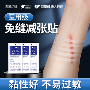 医用皮肤减张贴免缝胶带，剖腹产防止增生疤痕，贴愈合伤口免缝合器