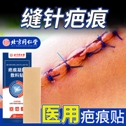 缝针疤痕修复去手术疤，专用硅凝胶疤痕修复贴预防增生长因子凹陷xs