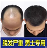 男士脱发严重专用洗发水防脱生发增发密发掉发排行榜育发密发中药
