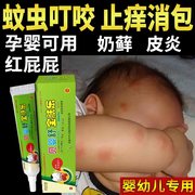 湿疹婴儿专用干性皮肤宝宝霜无激素儿童止痒去热疹专用根软膏疗治