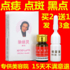 去痣点痣药水点痣膏，无痕韦医生除痣灵雀斑祛痣笔祛斑产品脸部