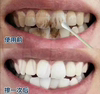 美白牙齿一擦白速效去黄牙烟牙菌斑牙垢黑渍洗牙粉液膏树脂牙斑净