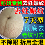 妊娠纹产后消除修复霜油预防孕妇专用生长纹肥胖纹，淡化紧致祛除去