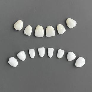 戴立克全瓷牙氟斑牙四环素牙大黄牙烟牙牙齿美白贴片瓷贴面