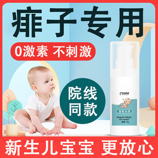 宝宝痱子膏去痱子止痒婴儿专用痱子粉儿童热痱子水药膏新生儿祛痱