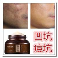 遮盖痘印痘疤淡化面膜去除女凹洞，修复祛凹陷疤痕，灵痘疤消印痘痘坑