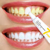 牙齿美白 速效 黄牙牙黄去黄神器焕颜精华牙渍牙垢去除器一擦即除