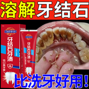 牙膏抗敏美白去黄去口臭强力去烟渍牙结石牙膏溶SC