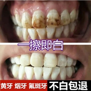 牙齿美白速效去除黄牙烟渍氟斑牙，清洁去黄洗牙液洁白牙，贴变白神器(白神器)