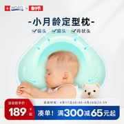美国hoag定型枕头婴儿枕夏季宝宝纠正头型，0-1岁新生儿矫正舟状头
