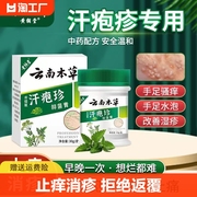 云南本草汗孢疹膏汗包膏泡疱疹手上小水泡脱皮痒汗状专用软膏成人