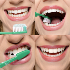 牙齿去黄牙黑牙牙垢洗牙粉快速牙膏