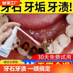 牙结石去除器溶解除牙石非速效漱口水洗牙齿污垢牙黄牙垢清除神器