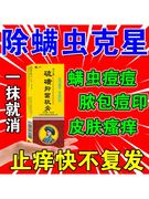 螨虫止痒药膏螨虫特效药除螨虫，脸部清洁后背，祛痘淡化痘印杀菌药膏