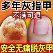 灰指甲甲沟炎特效专用日本小林抑菌液根指甲剪治CC