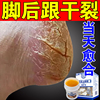 治手裂的药膏防皲裂脚后跟干裂专治手指开裂脱皮季节性手脚裂口CQ