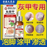 灰指甲灰指抑菌液真菌脚气感染去除增厚软化黑甲灰甲药杀菌膏液用