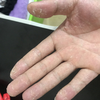 24手脱皮修复霜手掌手指蜕皮严重专用儿童，护手蜕皮手足起皮掉皮膏