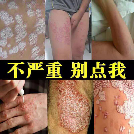 专治特效
