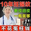 去除妊娠纹修复霜孕妇产后消除紧致去大腿妊辰纹肥胖纹生长纹学生