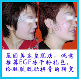 买460送300以上礼包  效果超好的医用级EGF冻干粉（附海量好评）