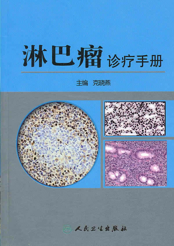 正版/ 淋巴瘤诊疗手册 克晓燕. /满88包邮